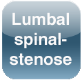 Lumbal spinalstenose